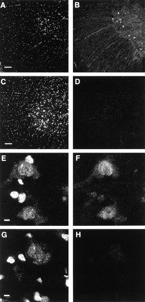 Confocal Laser Scanning Photomicrographs Of Coronal Sections Of Adult