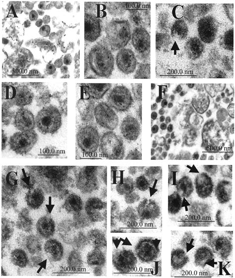 Electron Microscopy Hiv