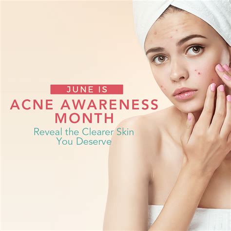 Acne Awareness Month Graphic Zel Skin And Laser Specialists Now Schweiger Dermatology Group