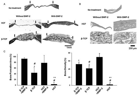 Histological Analysis Of Regenerated Bone A B Goldner S Trichrome