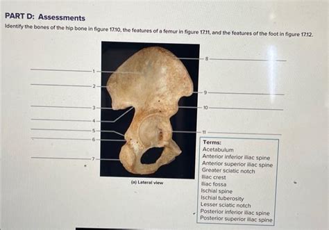 Solved Part D Assessments Identify The Bones Of The Hip Chegg