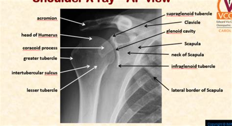 Anat Anatomical Correlations In Radiology Of The Upper Extremity