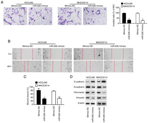 Interaction Between MiR206 And LncRNA MALAT1 In Regulating Viability