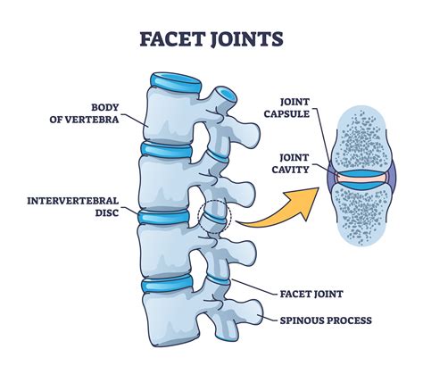 Chronic Neck Pain Causes: Discs & Facet Joints Explained