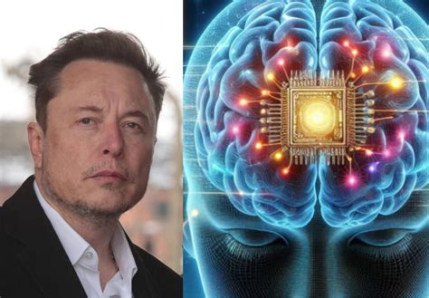 Neuralink De Elon Musk Realiza El Primer Implante De Chip Cerebral En