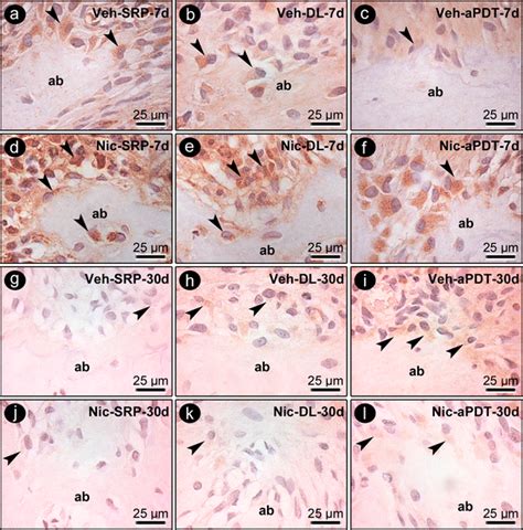 Immunostaining For Rankl And Opg In The Furcation Region Of The Left