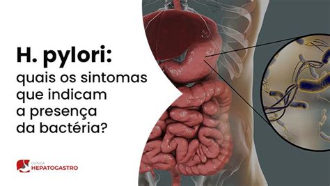 H Pylori Quais Os Sintomas Que Indicam A Presen A Da Bact Ria