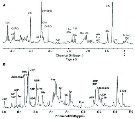 A D H Nmr Spectrum Region Showing The Metabolite Resonances From