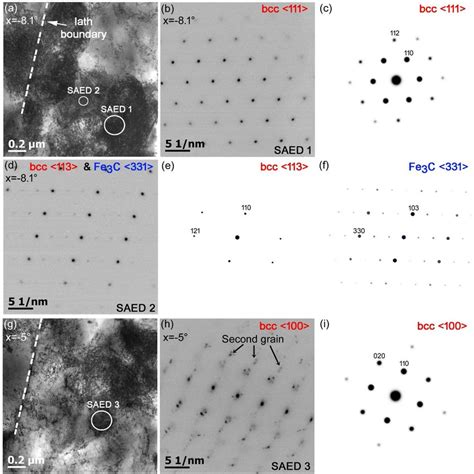 A TEM Bright Field Image Of The Same Area As In Fig 2 With A