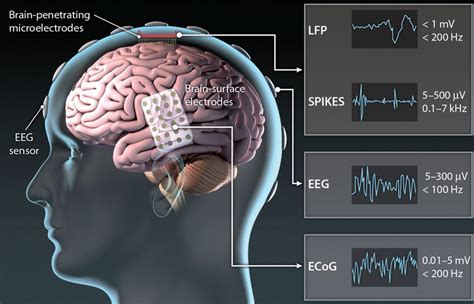 Translating The Brain Machine Interface Science Translational Medicine