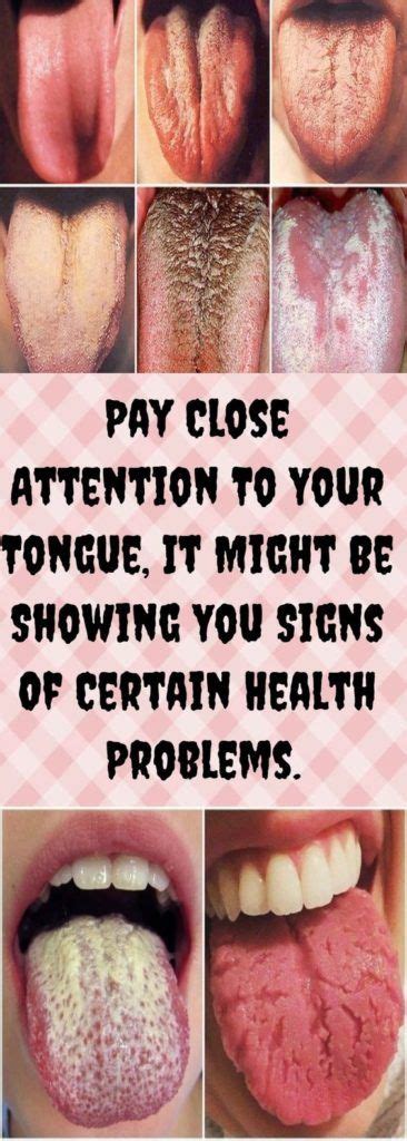 What Your Tongue What Your Tongue Says About Your Health Health Problems Health Health Tips