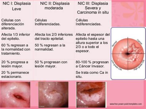 CÁncer Invasor De CÉrvix Y Vagina Mind Map