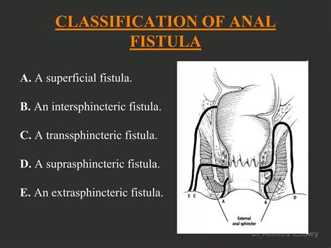 Anal Perianal Imaging Part 2 Perianal Fistula CT MRI Dr Ahmed Esawy PDF