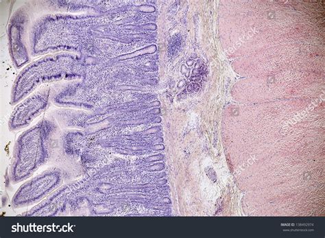 cross section small intestine stock photo  shutterstock