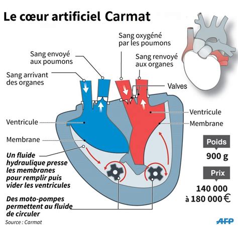 Coeur artificiel Carmat début de la dernière phase des essais