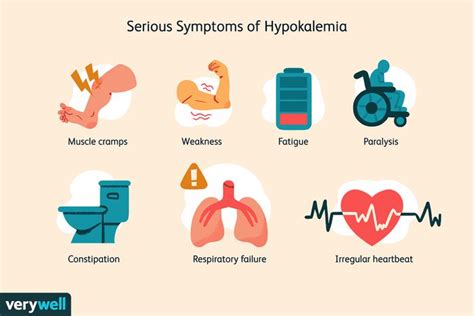 Hypokalemia: Overview and More