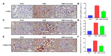 Figure 2 From Gastrodin Attenuates Renal Injury And Collagen Deposition