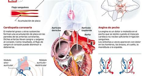 Las Enfermedades Que Afectan Al Coraz N Las Principales Causas De
