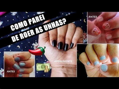 COMO PARAR DE ROER AS UNHAS DICAS YouTube