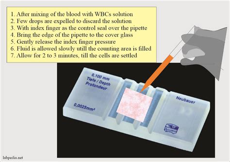 White Blood Cell Total Leucocyte Count And TLC Solution Formula