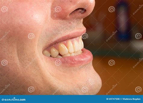 Profilo Di Sorriso Dei Denti Fotografia Stock Immagine Di Aperto