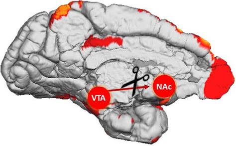 Nac Pathway Localisation Of Nachrs In The Reward Pathway A Human Left