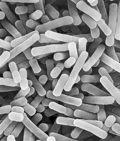 Lactobacillus bulgaricus, yogurt bacterium, SEM - Stock Image - C037 ...