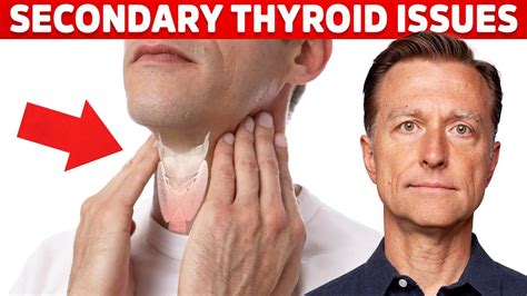 Most Thyroid Issues Are Secondary To Other Problems Dr Berg