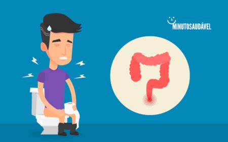 Fissura Anal Veja Como Tratar E Quais Os Cuidados MS