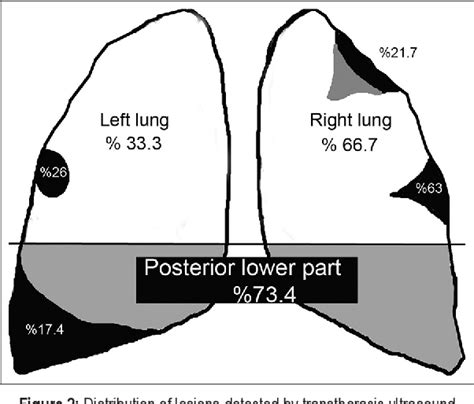 Figure 1 From The Role Of Thoracic Ultrasonography In The Diagnosis Of