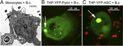 ASC and pyrin are colocalized with intracellular B. cenocepacia. (A ...