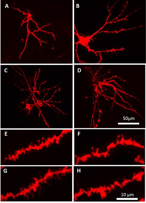 Dendritic spines on medium spiny neurons in the nucleus accumbens ... 