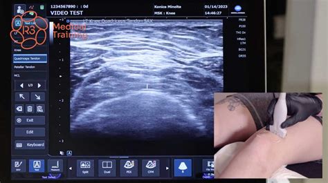 Musculoskeletal Msk Diagnostic Ultrasound Video Series Cme