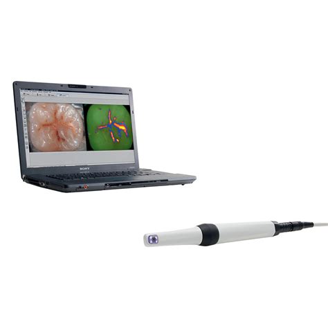 Durr Vistacam Ix Intraoral Camera