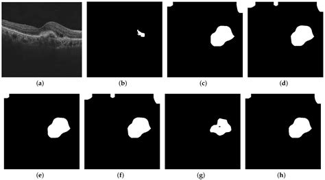 Diagnostics Free Full Text Deep Learning Based Visualization And