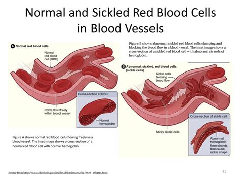 Alteration In Hematologic Function Ppt Download