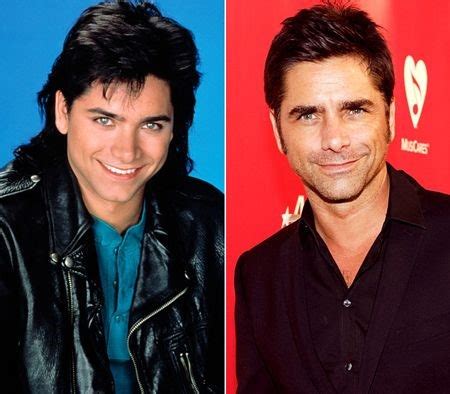 John Stamos before and after plastic surgery 04 – Celebrity plastic ...