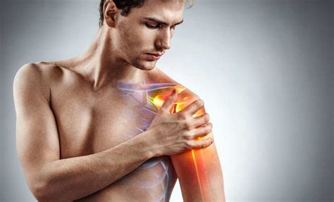 Suprascapular Neuropathy A Common Cause Of Shoulder Pain