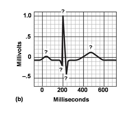 Figure 13 12 B A Ecg Pattern Diagram Quizlet