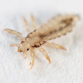 7 Common Lice Symptoms: Do You Have Lice?