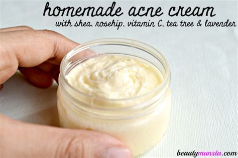 Natural Homemade Cream for Acne and Pimples - beautymunsta