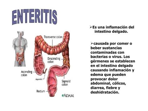 Sistema Digestivo Enfermedades