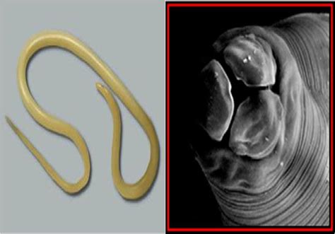 Ascaris Lumbricoides Habitat And External Morphology Microbe Notes Riset