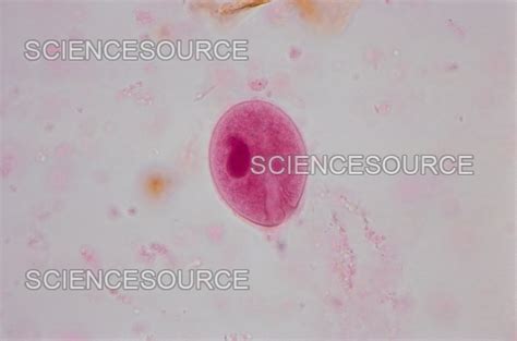 Balantidium Coli Cyst And Trophozoite