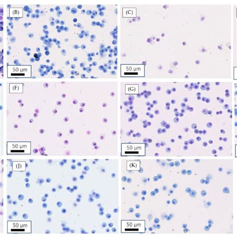 Inflammatory Cells In Bronchoalveolar Lavage Fluid Balf With Cytospin