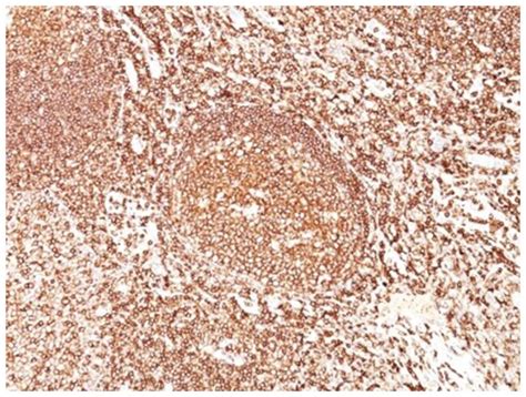 B Cd R Antibody F Azide And Bsa Free Novus Biologicals