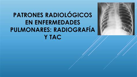 Solution Patrones Radiol Gicos En Enfermedades Pulmonares Studypool