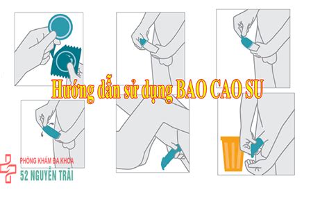 Hướng dẫn sử dụng bao cao su đúng cách dành cho nam giới