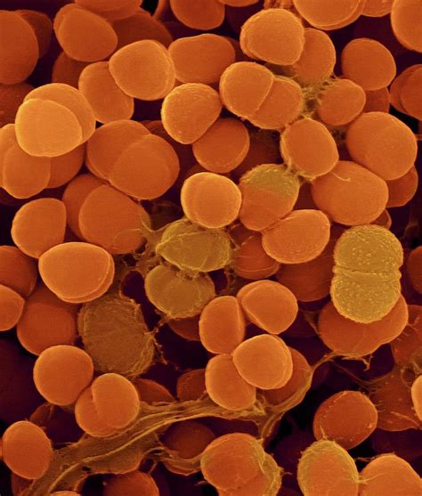 Staphylococcus Haemolyticus #4 Photograph by Dennis Kunkel Microscopy ...