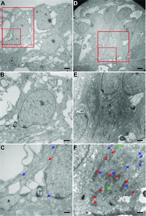 Transmission Electron Microscopy Tem Of Lens Epithelial Like Cells